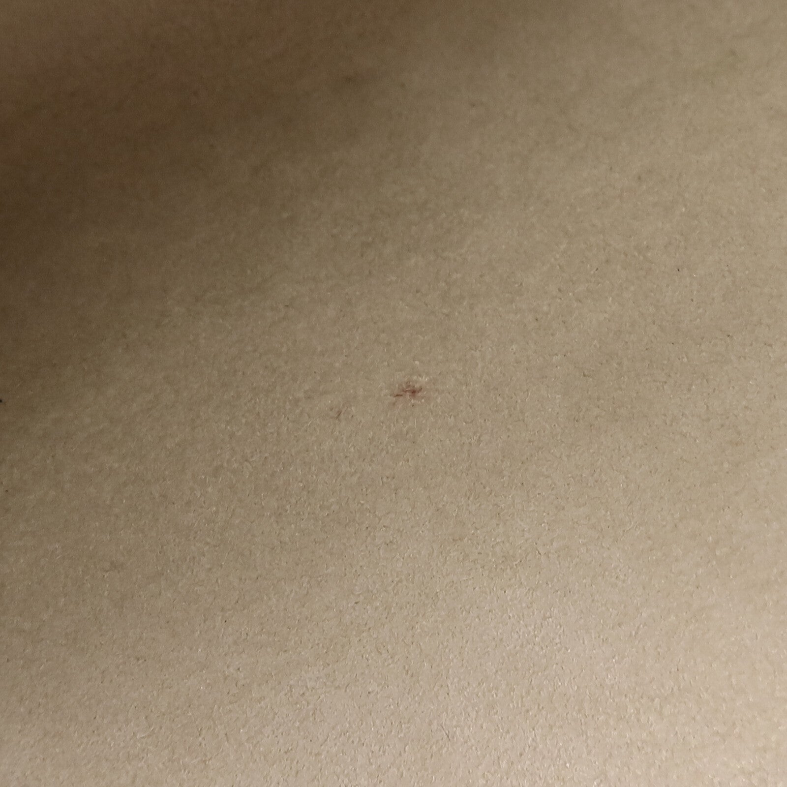 LOUIS VUITTON Epi Twist MM鏈帶肩背袋